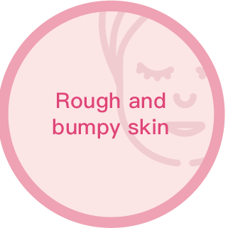 Rough and Bumpy Skin